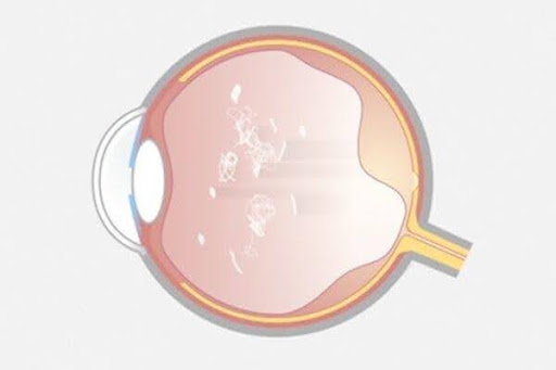 Cross section of the eye